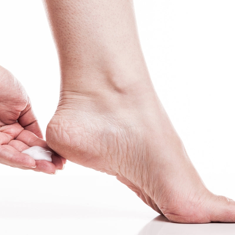 Pieds secs et crevassés : 5 conseils pour retrouver des pieds doux et hydratés !