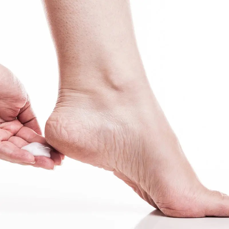 Pieds secs et crevassés : 5 conseils pour retrouver des pieds doux et hydratés !